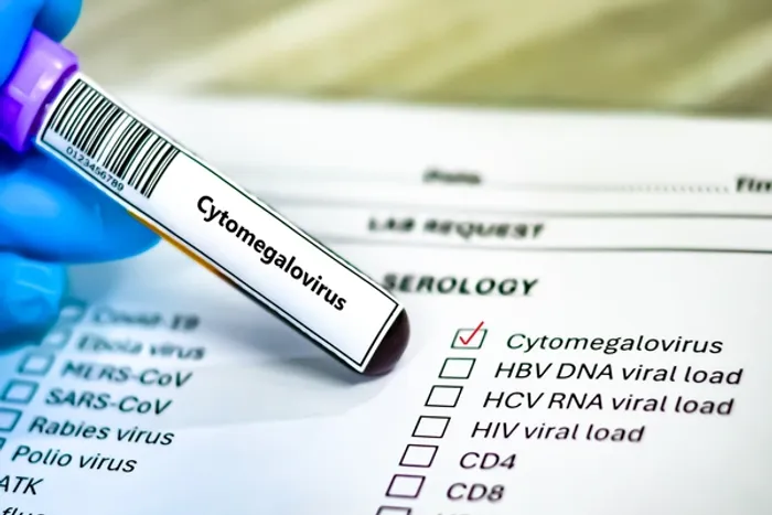 cytomegalovirus test